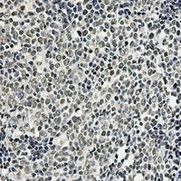 hnRNP I Rabbit Monoclonal Antibody