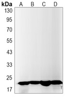 IL-26 Rabbit Monoclonal Antibody