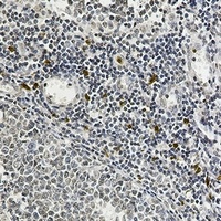 IL-26 Rabbit Monoclonal Antibody