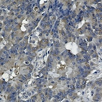 HSP90 beta Rabbit Monoclonal Antibody
