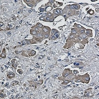 BID Rabbit Monoclonal Antibody