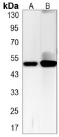 p53 (Phospho-S6) Rabbit Monoclonal Antibody
