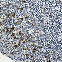p53 (Phospho-S6) Rabbit Monoclonal Antibody