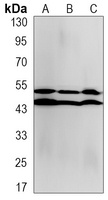 JNK1/2/3 (Phospho-T183/Y185) Rabbit Monoclonal Antibody