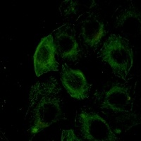 Filamin A/B (Phospho-S2152/2107) Rabbit Monoclonal Antibody