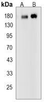 EGFR (Phospho-Y1173) Rabbit Monoclonal Antibody