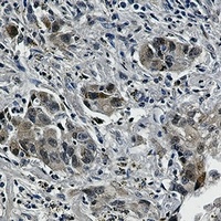 EGFR (Phospho-Y1173) Rabbit Monoclonal Antibody