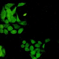 EGFR (Phospho-Y1173) Rabbit Monoclonal Antibody
