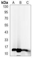 Histone H3 (Acetyl-K27) Rabbit Monoclonal Antibody