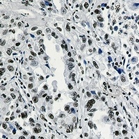 Histone H3 (Acetyl-K27) Rabbit Monoclonal Antibody