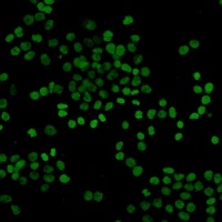 Histone H3 (Acetyl-K27) Rabbit Monoclonal Antibody