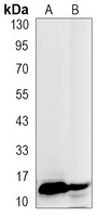 Histone H3 (TriMethyl-K27) Rabbit Monoclonal Antibody