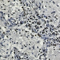 Histone H3 (TriMethyl-K27) Rabbit Monoclonal Antibody