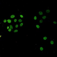 Histone H3 (TriMethyl-K27) Rabbit Monoclonal Antibody
