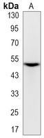 Vimentin (Phospho-S56) Rabbit Monoclonal Antibody