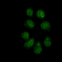 Vimentin (Phospho-S56) Rabbit Monoclonal Antibody