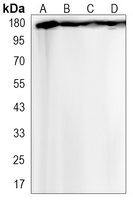 VEGFR1 Rabbit Monoclonal Antibody