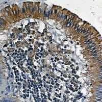 VEGFR1 Rabbit Monoclonal Antibody