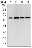 TRAF6 Rabbit Monoclonal Antibody