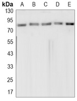 Topoisomerase 1 Rabbit Monoclonal Antibody