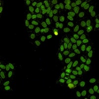Topoisomerase 1 Rabbit Monoclonal Antibody