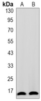 TOM20 Rabbit Monoclonal Antibody