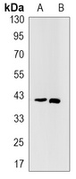 STING Rabbit Monoclonal Antibody