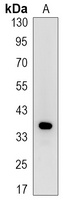 Synaptophysin Rabbit Monoclonal Antibody