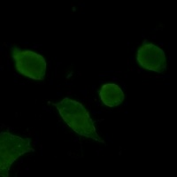 Synaptophysin Rabbit Monoclonal Antibody