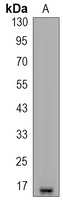Survivin Rabbit Monoclonal Antibody