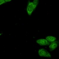 Survivin Rabbit Monoclonal Antibody