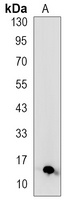 S100-A4 Rabbit Monoclonal Antibody
