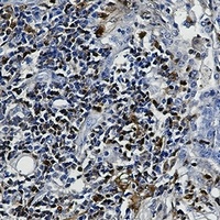 S100-A4 Rabbit Monoclonal Antibody