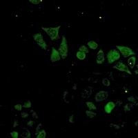 S100-A4 Rabbit Monoclonal Antibody