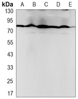 PRMT7 Rabbit Monoclonal Antibody