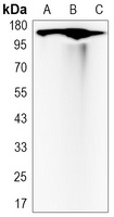 c-Met Rabbit Monoclonal Antibody