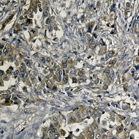 c-Met Rabbit Monoclonal Antibody