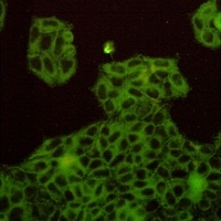 c-Met Rabbit Monoclonal Antibody