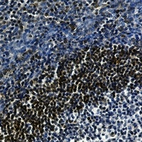 LTA4H Rabbit Monoclonal Antibody