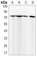 FUBP1 Rabbit Monoclonal Antibody