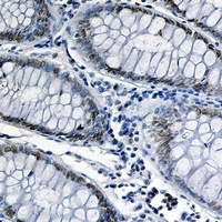 FUBP1 Rabbit Monoclonal Antibody