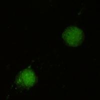 FUBP1 Rabbit Monoclonal Antibody