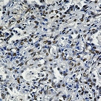 FTO Rabbit Monoclonal Antibody