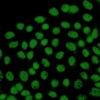 FTO Rabbit Monoclonal Antibody