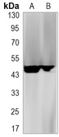 CD95 Rabbit Monoclonal Antibody