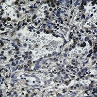 CD95 Rabbit Monoclonal Antibody