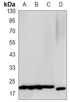 4EBP1 Rabbit Monoclonal Antibody