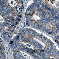 Catenin delta 1 Rabbit Monoclonal Antibody