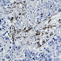 PGHS-2 Rabbit Monoclonal Antibody