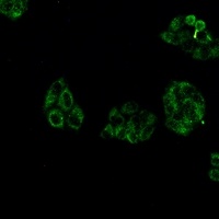 Collagen 3 alpha 1 Rabbit Monoclonal Antibody